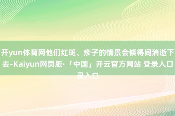 开yun体育网他们红斑、疹子的情景会倏得间消逝下去-Kaiyun网页版·「中国」开云官方网站 登录入口